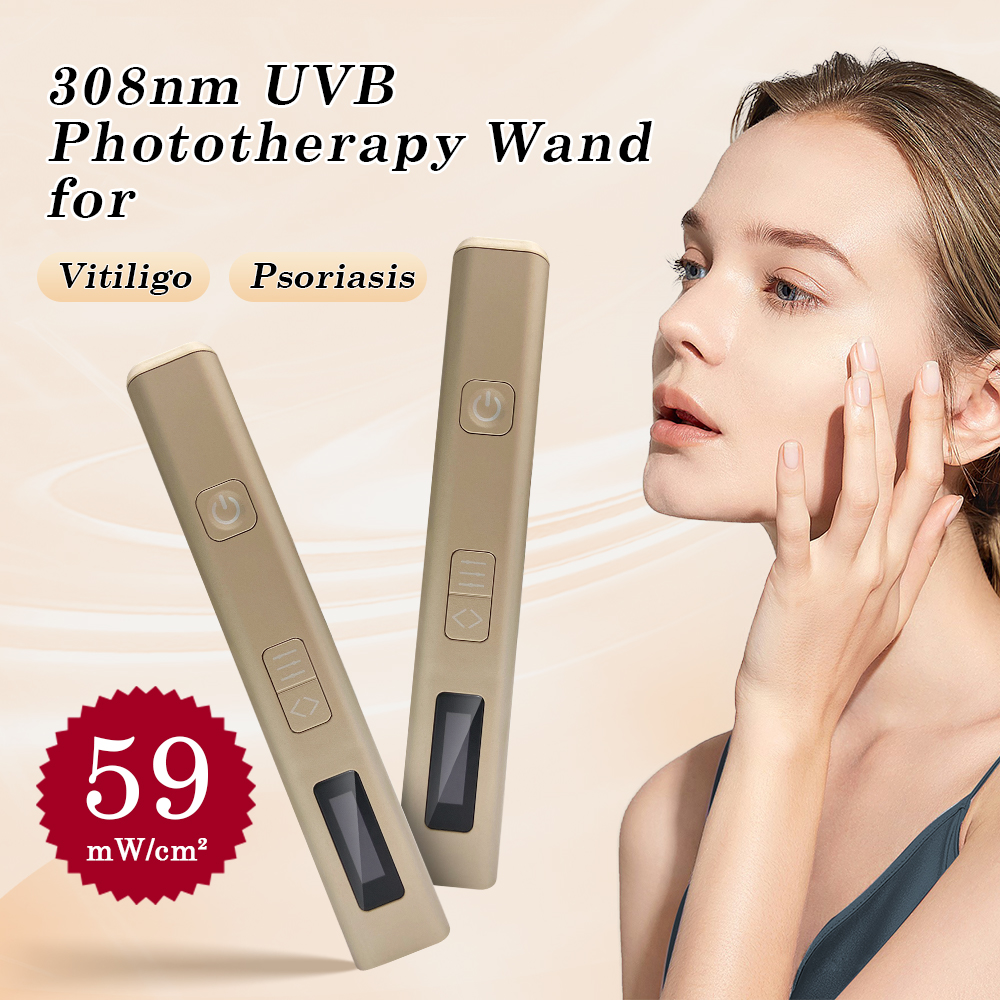 Skincare Glowing - 1PC Pen Shape 308nm LED UV