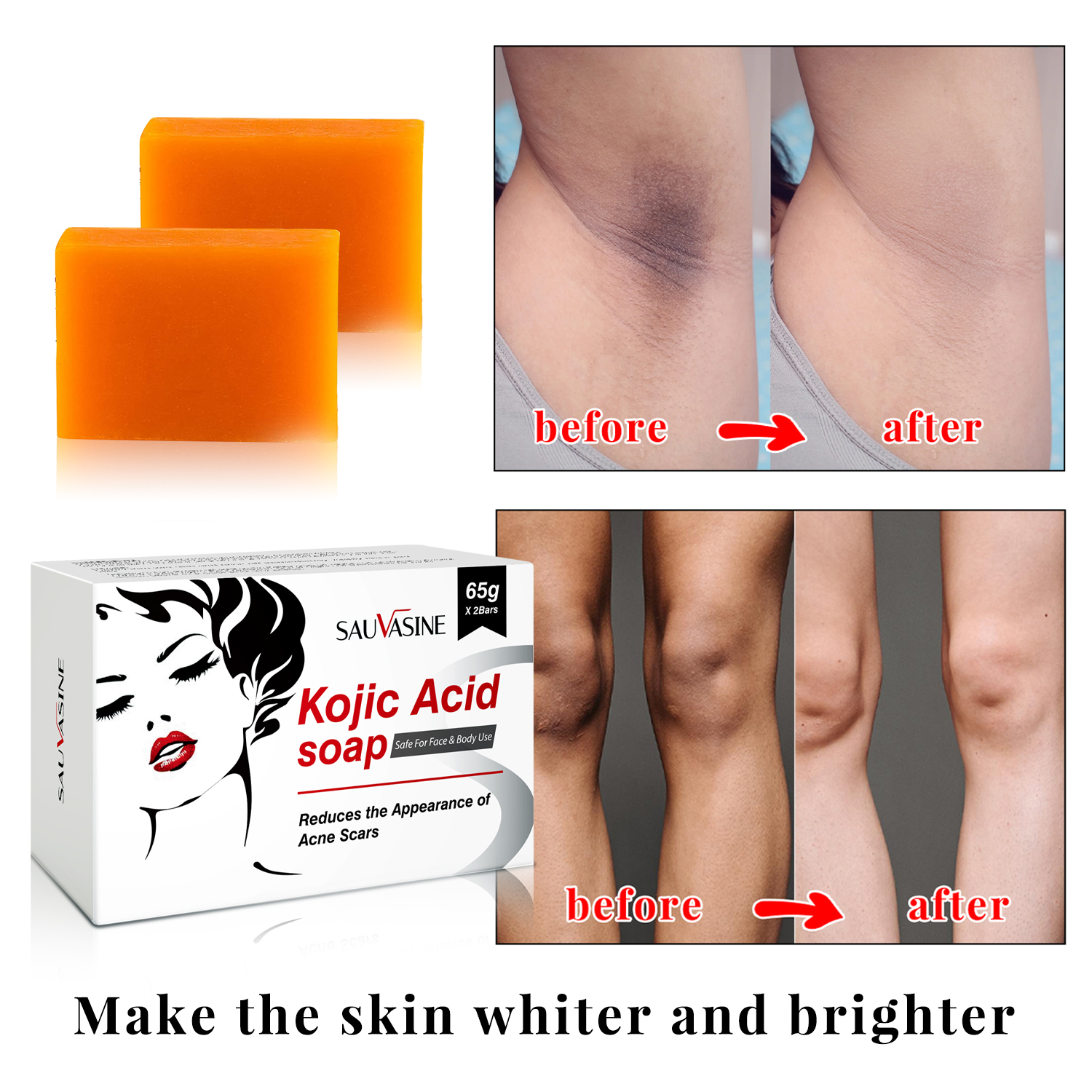 Kojic Acid Glow Soap Facial De – Skincare X2 recenzja i cena