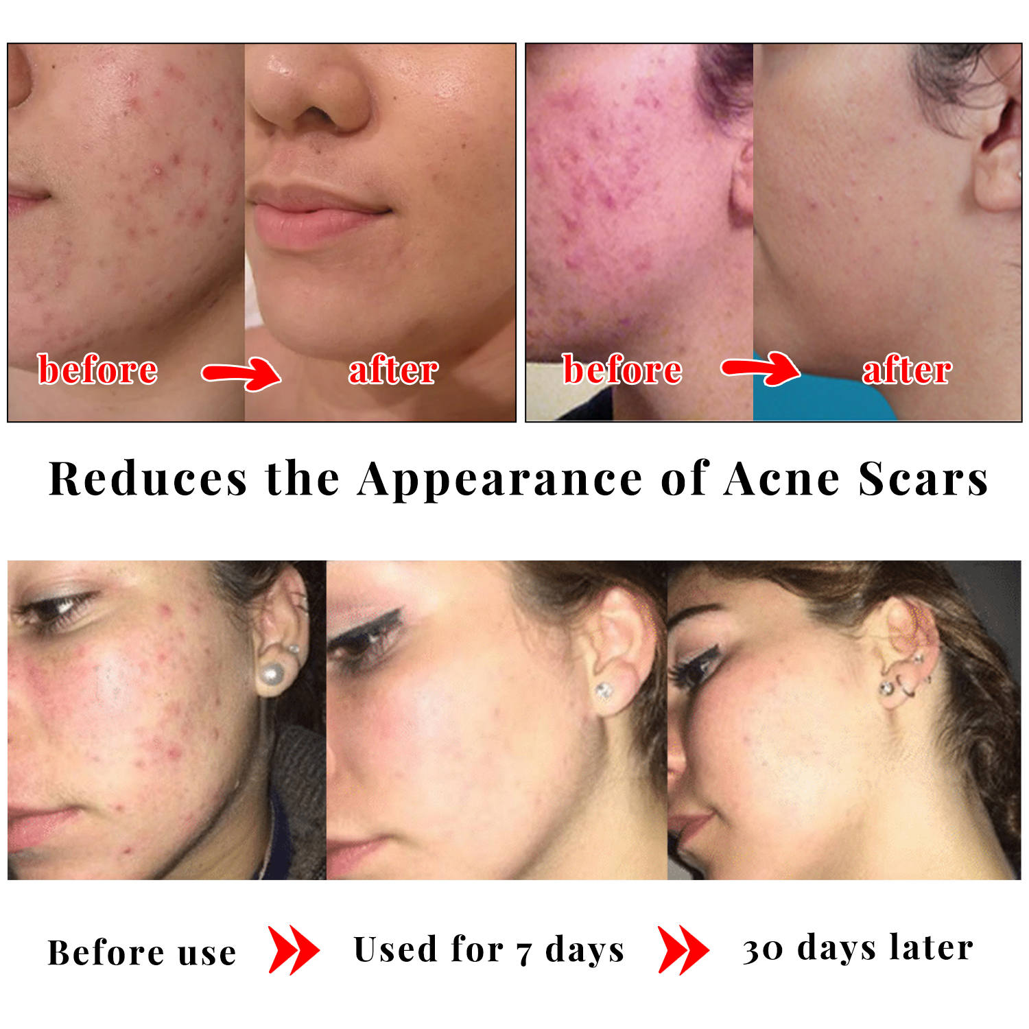 Kojic Acid Glow Soap Facial De – Skincare X2 recenzja i cena