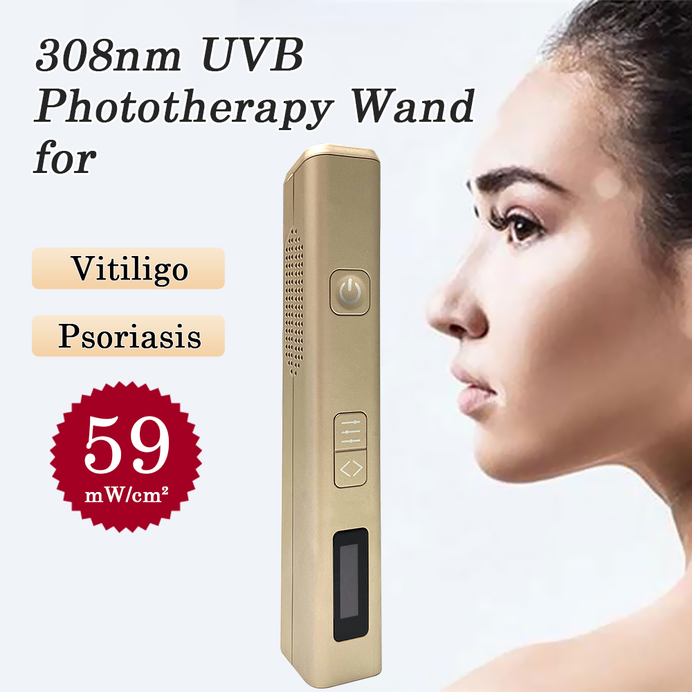 1PC Pen Shape 308nm LED UV lig – Skincare Glowing recenzja i cena